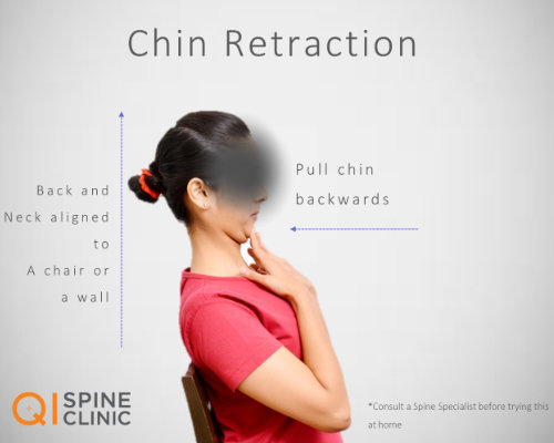 chin RETRACTIONS
