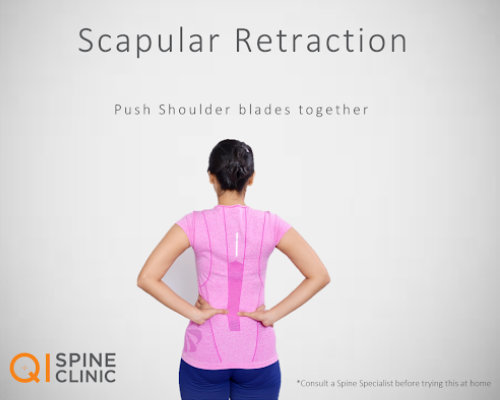 SCAPULAR RETRACTIONS