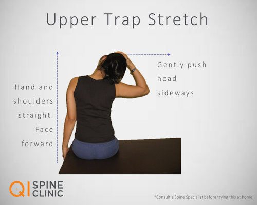 Upper Trap Stretch