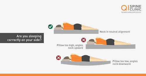 How to Sleep With Lower Back Pain: 4 Best Positions to Prevent Pain