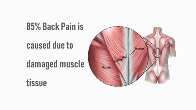 Causes of back pain and back pain treatment