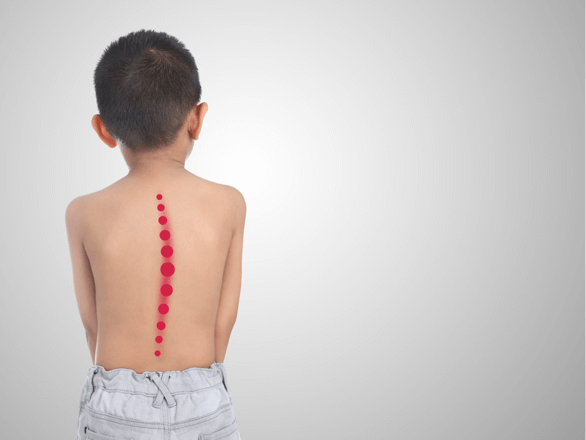 Back Pain among children: Diagnosis, Treatment & Cure at QI Spine Clinic
