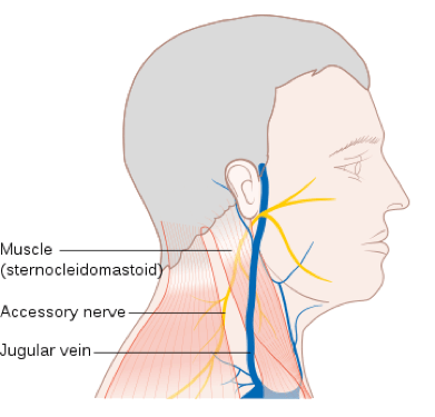 Condition - Headache with neck pain