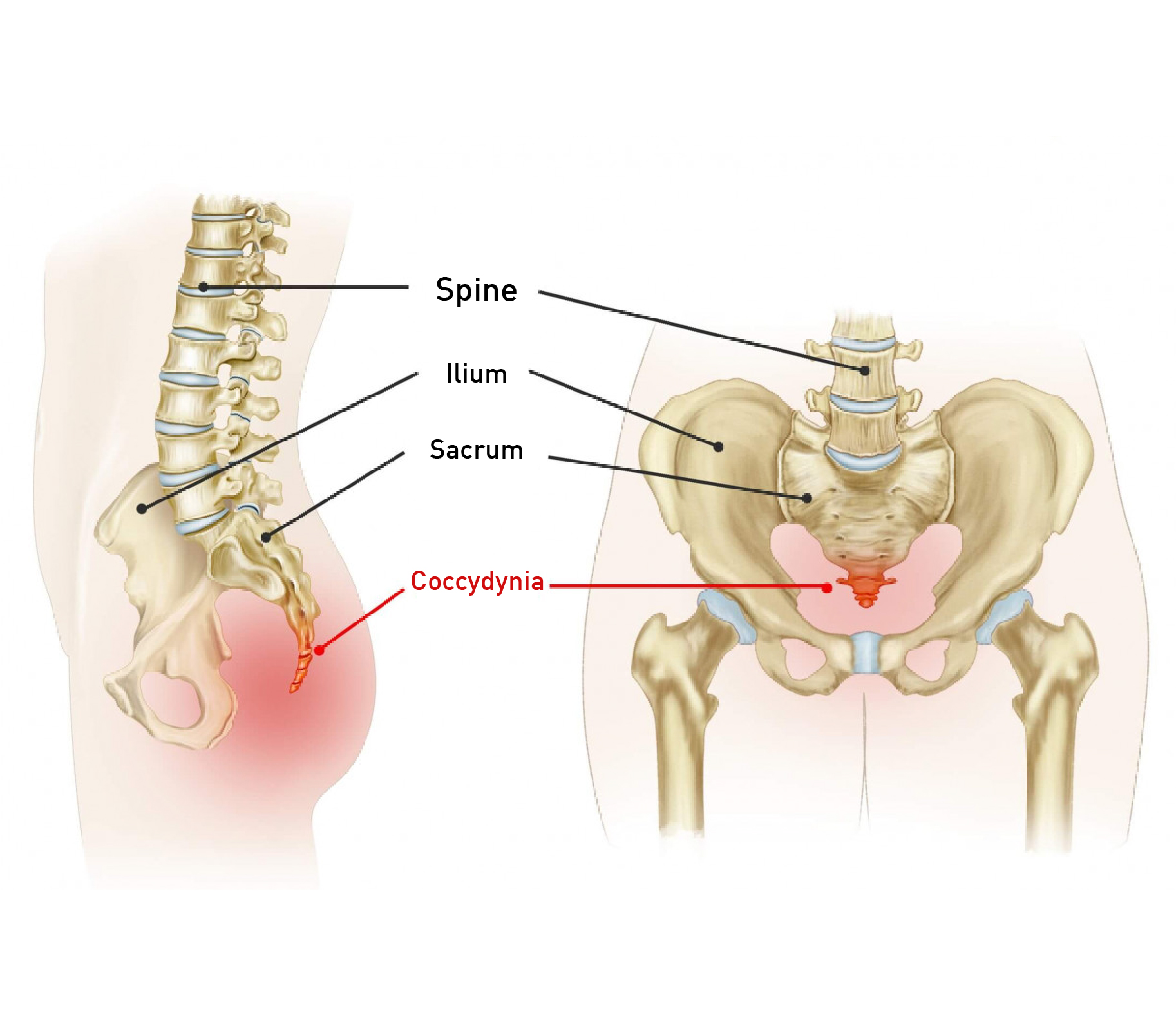 Coccydynia Bone Coccyx Bone