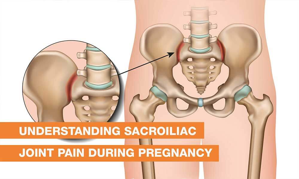 Understanding Sacroiliac Joint Pain During Pregnancy