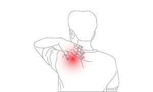 Neck Pain - Symptoms, Causes & Treatments