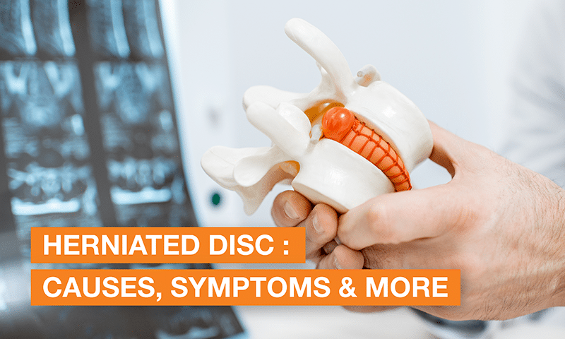 Slipped Disc Symptoms, Causes and Treatment