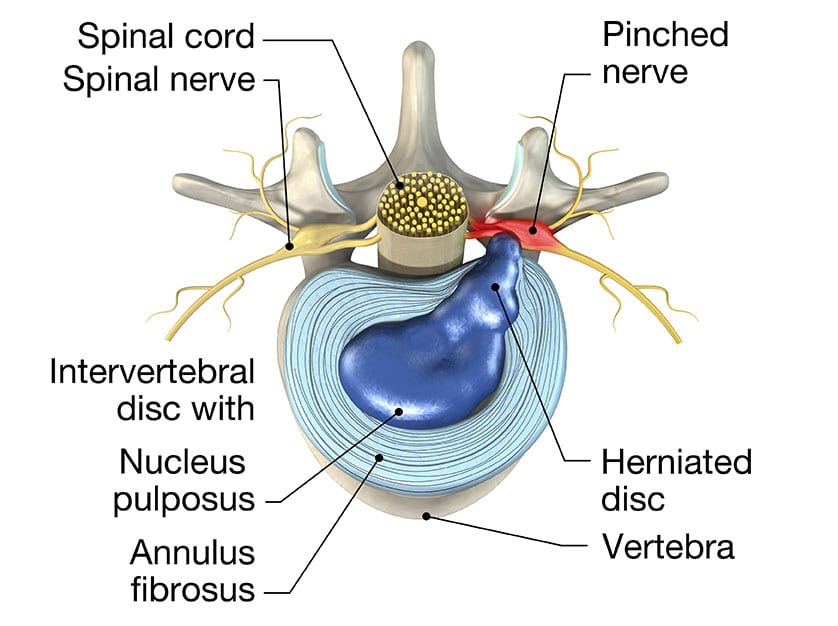 Qi spine