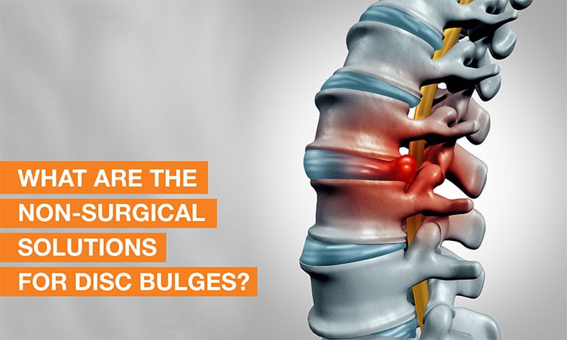 What are the non-surgical solutions for disc bulges?