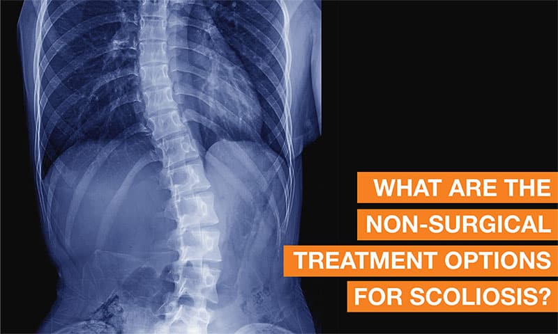 What are the non-surgical solutions for treating scoliosis?