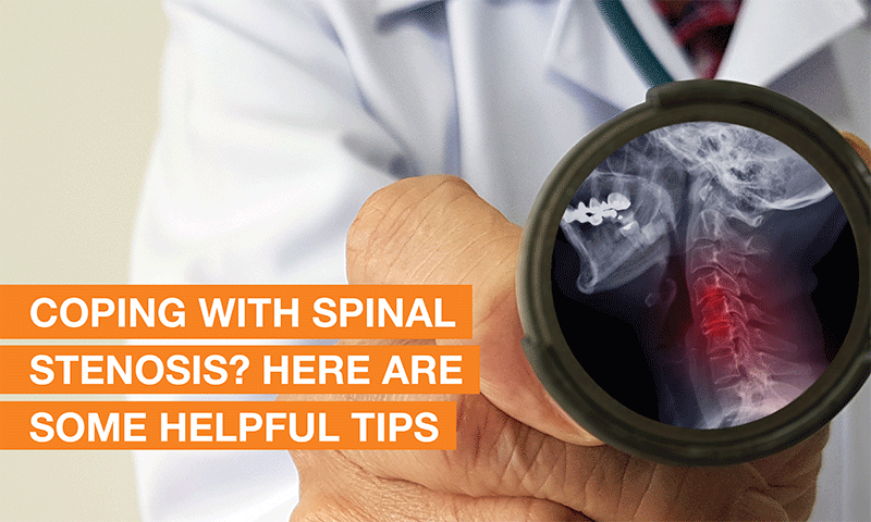How can I manage spinal stenosis? Here are some effective ways to manage this spinal condition
