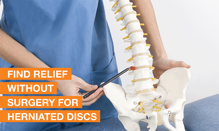 What are the non-surgical options for herniated discs?