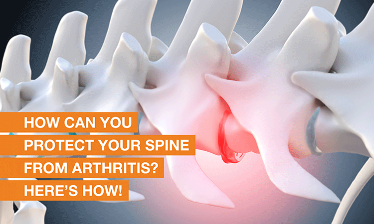 Effective strategies for preventing spinal arthritis and maintaining optimal spinal health