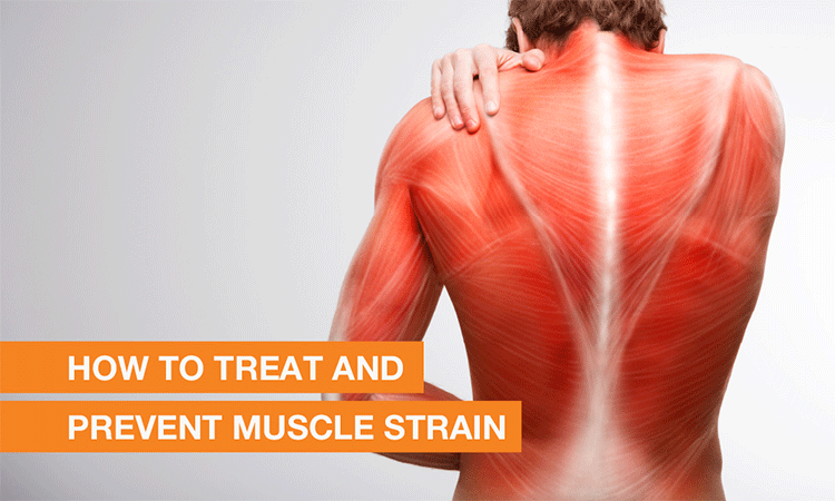 How to Treat and Prevent Muscle Strain