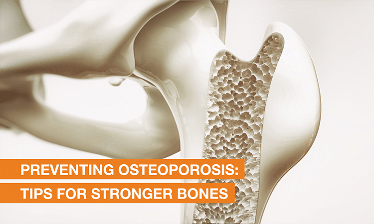 Blog Image - Preventing Osteoporosis: Tips for Stronger Bones