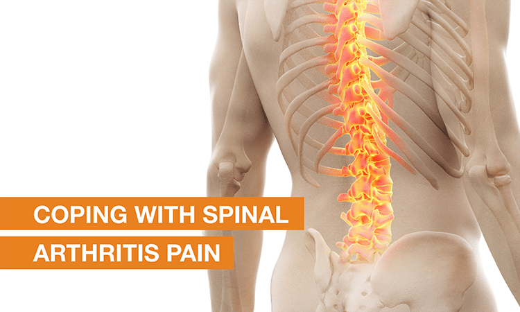 Blog Image - Coping with Spinal Arthritis Pain