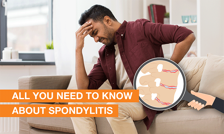 Blog Image - All You Need to Know about Spondylitis