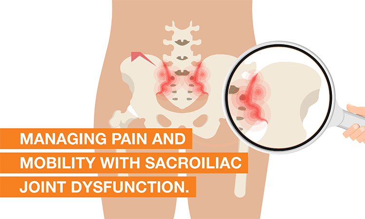 Managing pain and mobility with sacroiliac joint dysfunction
